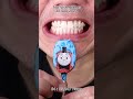 Satisfying Chewing ASMR #Compilation #ASMR #DoctorTristanPeh