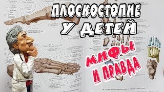 ПЛОСКОСТОПИЕ У ДЕТЕЙ. МИФЫ И ПРАВДА!