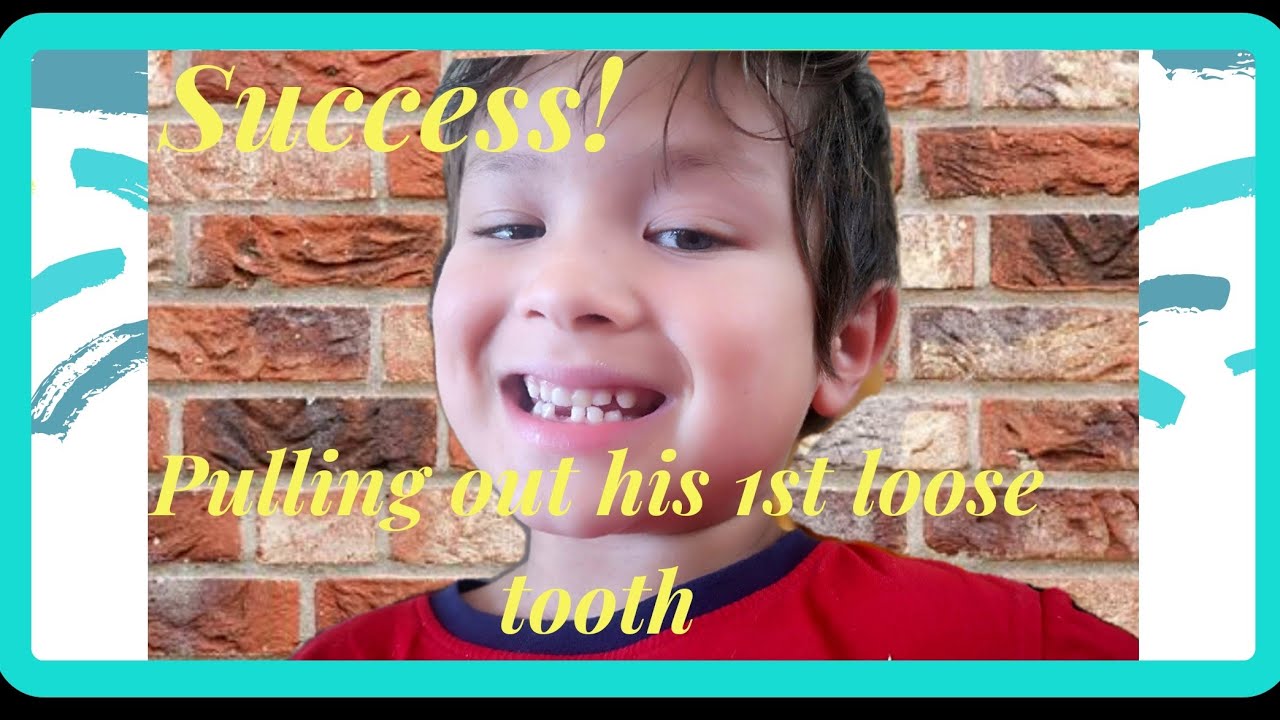 Heinrich's First Pulling out his loose Tooth. |How to pull out loose ...