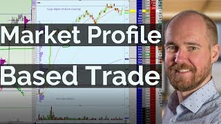 Market Profile Based Trade | Axia Futures