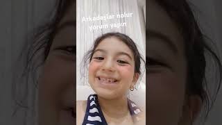 Sizin O Güzel Gözlerinizin Delisiyim Delisi Yüzümü Gösterdim