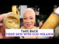 How To Get Rid of Dark Spots and Uneven Skin Tones on Melanin Rich Skin featuring GloMelanin