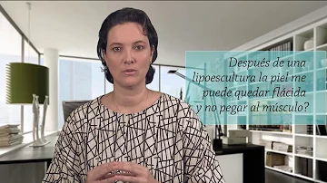 ¿Me dejará la liposucción la piel flácida?