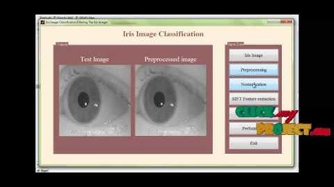 Final Year Projects 2015 | Iris Image Classification Based on Hierarchical Visual