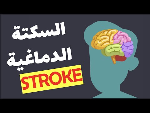 STROKE - How to detect it Early? السكتة الدماغية