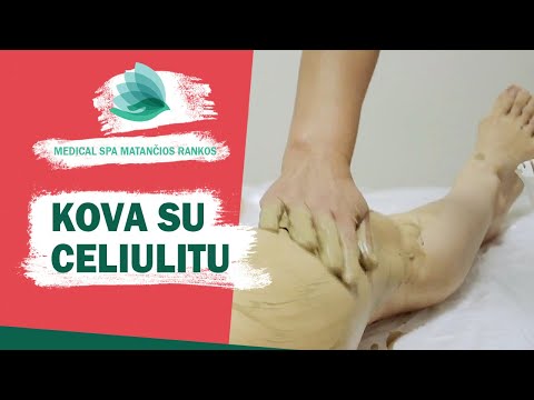 Video: Ši Nenumaldoma Kova Su Celiulitu