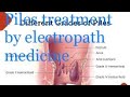 Piles treatment by electropath medicine