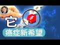 Can This Common Gas Help Treat Cancer She Can T Stand The Chemotherapy Can This Common Gas Help Treat Cancer She Can T Stand The Chemotherapy