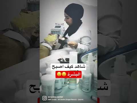 شاهد كيف اصبحت البشرة صافيه  مركز تجميل افيانا