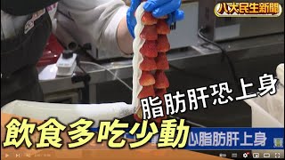 飲食不忌口少動 當心脂肪肝上身 |【用心顧健康】| 2022082114 @gtvnews27