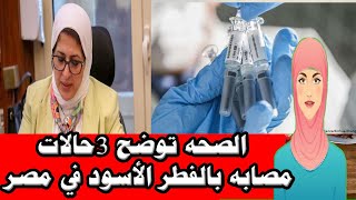 الصحه توضح 3حالات  مصابه بالفطر الأسود في مصر