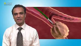 CIMS Hospital  Dr. Amit Patel  Bronchoscopy For Diagnosis & Treatment of Lung Diseases