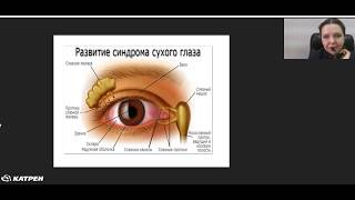 Вебинар &quot;Сухие и красные глаза - проблема не только окулиста&quot;