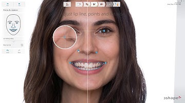 3Shape 트리오스 - 스마일 디자인 사용자 인터페이스