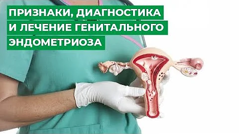 Признаки, диагностика и лечение генитального эндометриоза