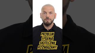 Najskuteczniejsze rozwiązanie problemu łysienia! #mikropigmentacjaskórygłowy