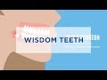 Wisdom Teeth: Pain or No Pain (:60)