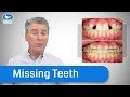 How Orthodontists deal with Missing Teeth - Save yourself years of pain, and cost.