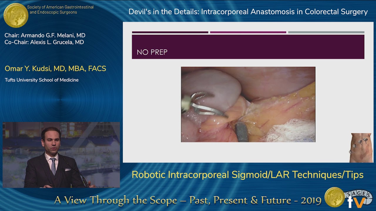 Robotic Intracorporeal Sigmoid/LAR Techniques/Tips YouTube