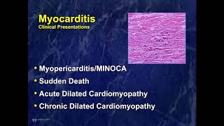 Presentation and Management of Myocarditis in 2021