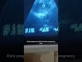First pregnancy Altra sound 6 week pregnancy #pregnancy #for you #draneela #prenancy journey #baby