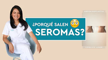 ¿Cómo eliminar un seroma en casa?