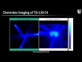 TG 119 C4 Plan on Viewray - Real-Time Cherenkov Imaging