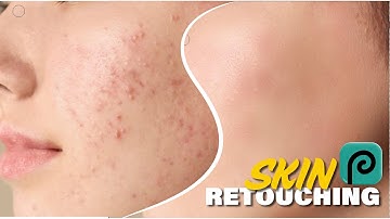 How to Remove Acne and Soften Skin in Photopea  High End Skin Softening  Remove Pimples