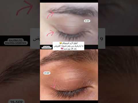    سيروم اليونا سيروم رموش السعودية دبي رياض جدة 