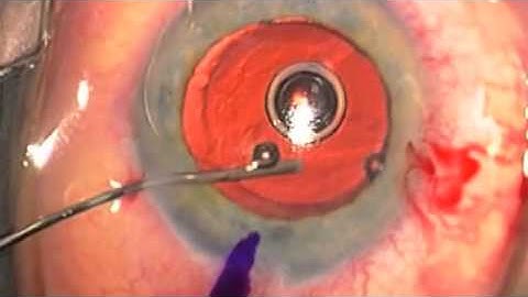 AT Torbi rotation 2012