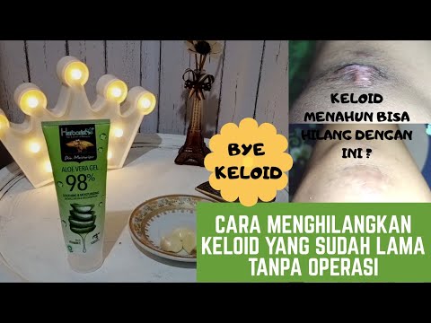 PART 1 : KELOID SEMBUH TOTAL CUMA PAKE BAWANG PUTIH? TANPA SUNTIK TANPA OPERASI [ CEK DESKRIPSI]