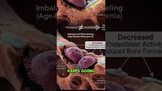 What Happens to Your Bones When You Stop Walking