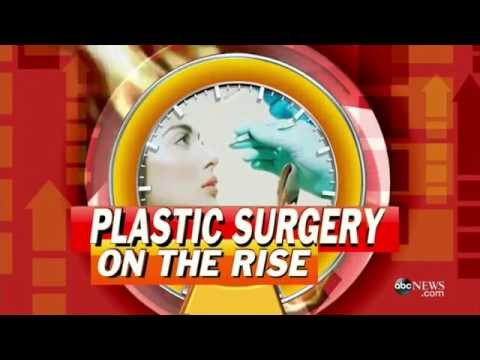 Good Morning America - Plastic Surgery Nation