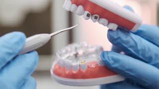 ¿Cómo cuidar los dientes de los niños?
