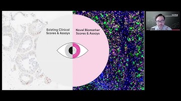AI Spatial Biomarkers & Diagnostics Are Critical for Precision Medicine