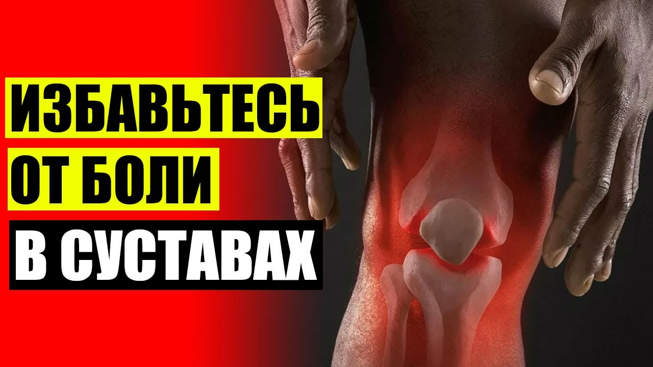 ПРОТИВОВОСПАЛИТЕЛЬНЫЕ ПРЕПАРАТЫ ДЛЯ СУСТАВОВ И МЫШЦ МАЗИ 🤥