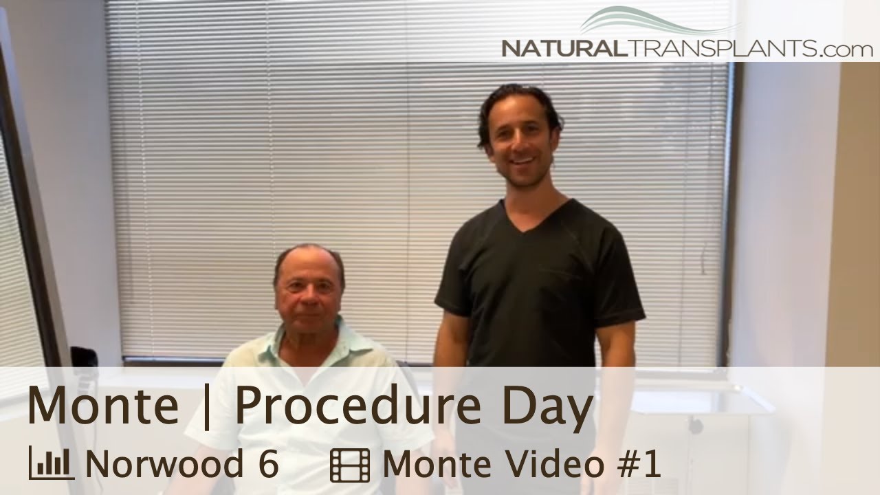 fue hair transplant month by month Norwood 6 Man Hair Transplant Surgery Day | Dr. Kevin Blumenthal (Monte)