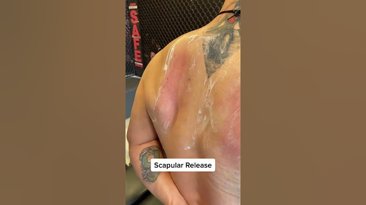 Scapula Release