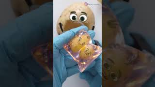 Potato C-Section - BABIES STILL IN AMNIOTIC SAC😱❤️ #fruitsurgery #shorts #asmr #animation #cute