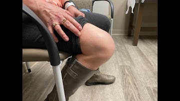 6 Week Follow Up Robotic (MAKO) Knee Replacement Doing Great | Dr. Robert Cagle