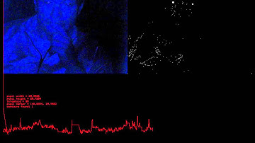 Pupil dilation tracker