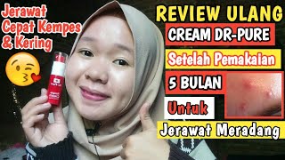 CREAM PIMPLE DR-PURE UNTUK JERAWAT MERADANG #Reviewjujur #Pemakaian5bulan