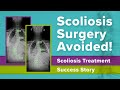 Scoliosis Surgery Avoided! Scoliosis Treatment Success Story