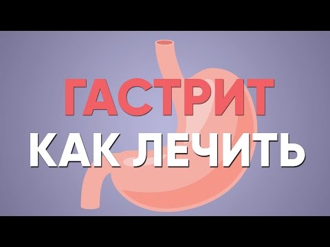 ГАСТРИТ что делать? | Симптомы | Лечение | Диета | Хронический Обострение | Как лечить | Доктор Фил