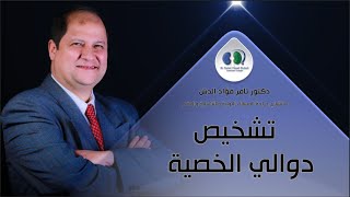 تشخيص دوالي الخصية - دكتور تامر فؤاد الدش