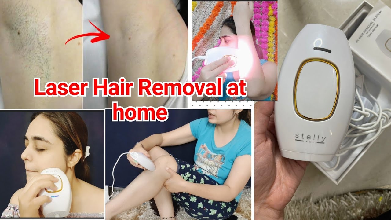 Laser Hair Removal at Home | Permanent Hair Removal Using Stelly IPL Hair removal Instrument