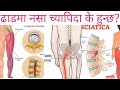 Sciatica in nepalidr bhupendra sha.octor sathi