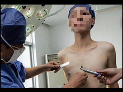 Девушка с вагинопластикой, биг грудь порно видео