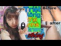 Mình Đã Triệt Lông Thành Công Tại Nhà Với Máy Triệt Lông Sau 2 Tháng l TMRBAE NAKED IPL hair removal