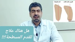 كيف نتعامل مع القدم المسطحة لدى الأطفال